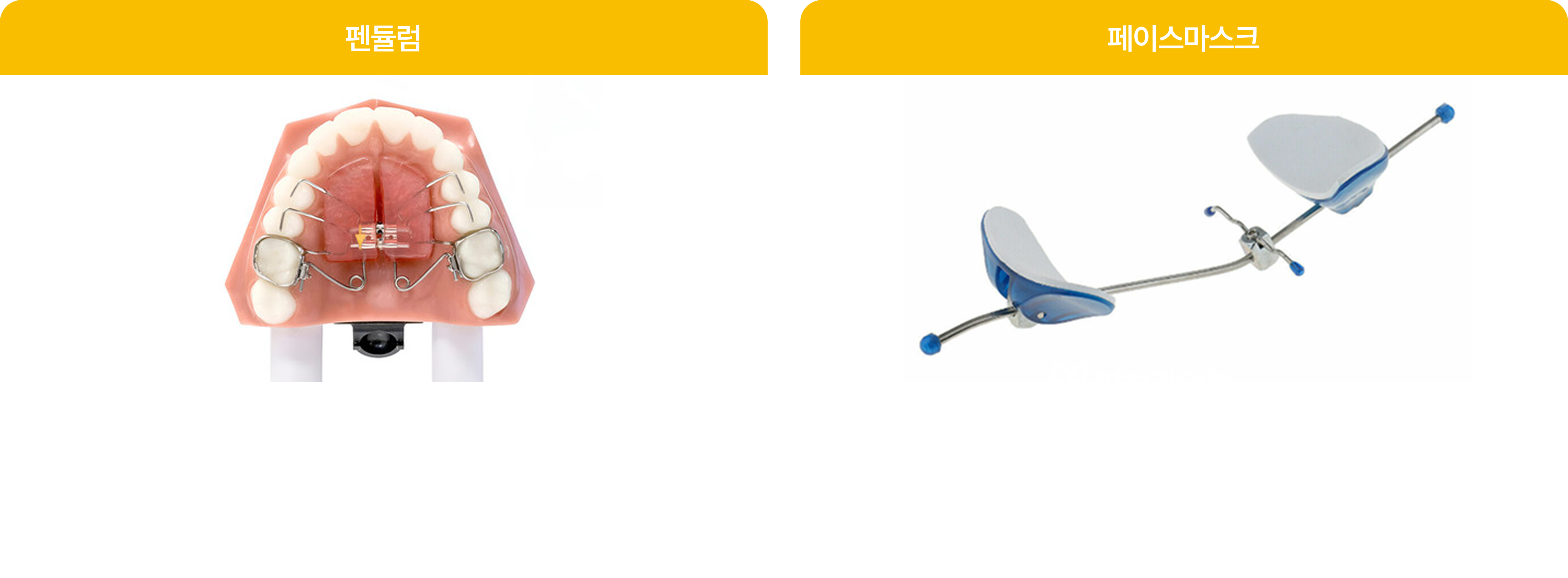 교정장치의 종류, 펜들럼, 페이스마스크